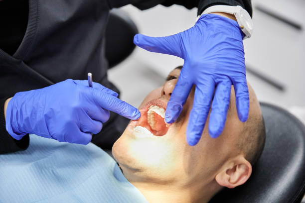 Best Knocked-Out Tooth Emergency  in Farmingdale, NJ